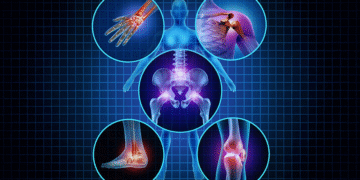 Joint Pain Relief